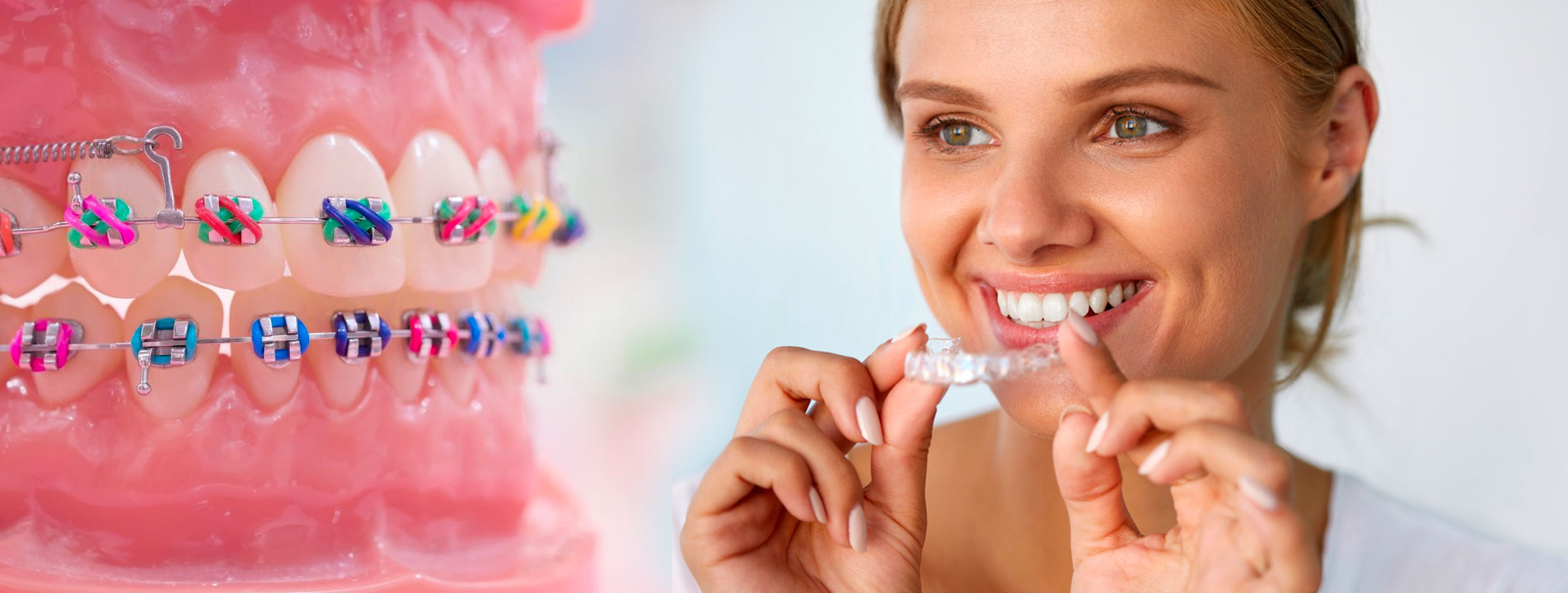 Ortodonti Diş teli çeşitleri Ortodonti Diş teli çeşitleri