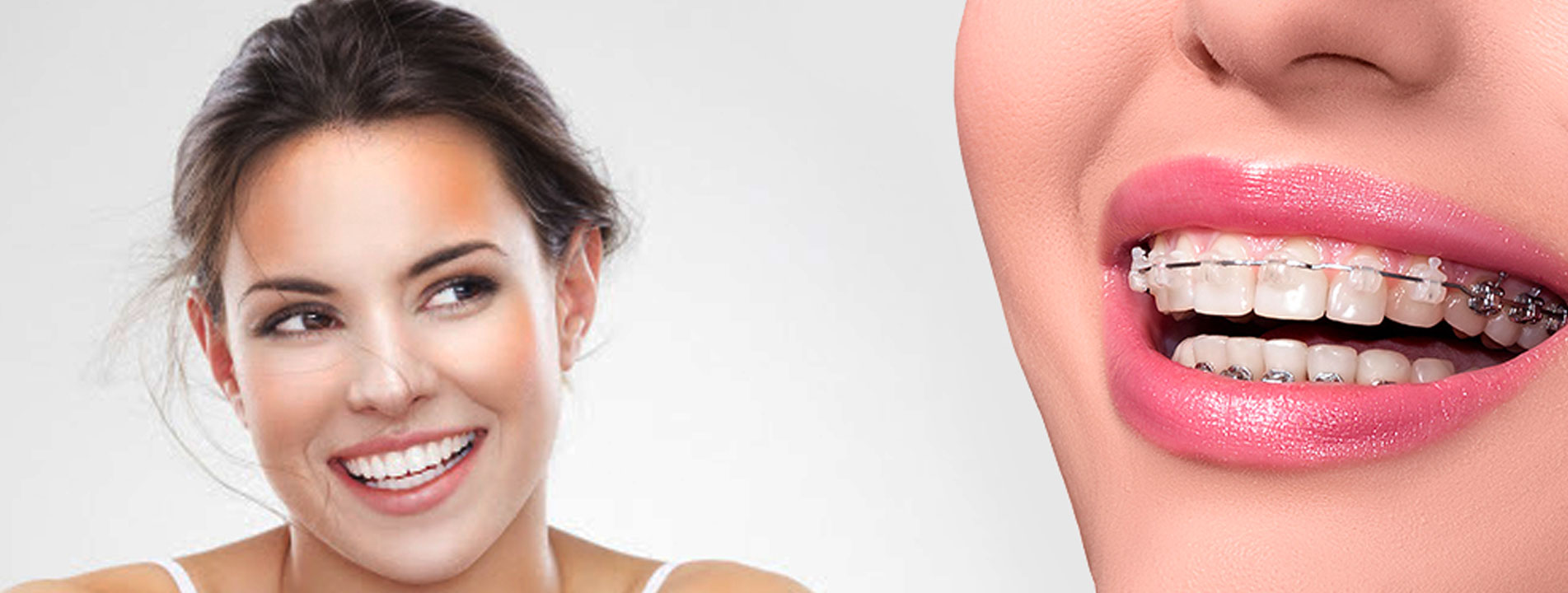 Ortodontik Tedavi Ortodontik Tedavi